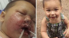 Kukláči počas záťahu takto zranili 1,5 ročného chlapčeka!