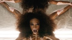 Najodvážnejšie zábery Winnie Harlow: Rozkročila nohy do objektívu