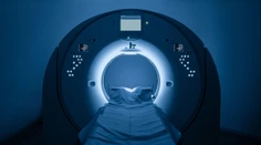 Muža zabil prístroj magnetickej rezonancie. Do miestnosti vstúpil s ťažkou reťazou na krku