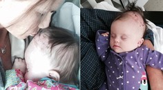 Lekári odpísali ešte nenarodené dievčatko. Dnes je všetko inak