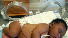 Žena porodila poriadneho cvalíka. Po narodení vážil šesť kíl!