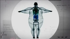 Ako vyzerá 400-kilový muž pod röntgenom? Pozrite sa na ten kontrast