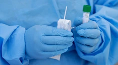 Prečítajte si, čo presne je potrebné urobiť pred vyšetrením na COVID-19