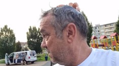 Dohra útoku vajcom na poslanca Pročka. Mesto prešetrí postup polície