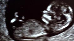 Žiari šťastím. Po dvoch adopciách nosí herečka pod srdcom dieťa