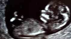Žiari šťastím. Po dvoch adopciách nosí herečka pod srdcom dieťa