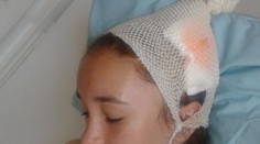 Natáliu na telocviku zranila železná guľa. Rozhodli o treste pre riaditeľa a učiteľa