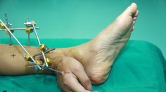 Myslíte si, že sa táto operácia nepodarila? Omyl!