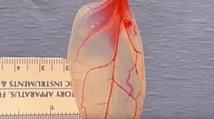 Vedci vytvorili srdcové tkanivo zo špenátu. Hovoria o revolúcii v medicíne