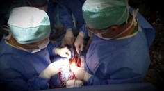 Vo Viedni vykonali prvú transplantáciu pľúc pacientovi s koronavírusom