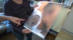 Bábätko zabila zákerná infekcia. Nevedia, kde sa nakazilo