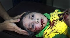 Tvár sýrskeho dievčatka obletela svet. UNICEF je označil za fotku roka