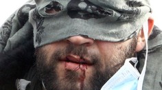 Migranti si na protest proti rušeniu tábora zašili ústa