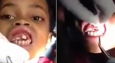 Prípad, z ktorého onemel zubár. Tieto zvieratká vytiahol žiačke z úst