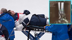 Sersen ukázal röntgenové snímky. Spolu so Šťastným sa budú liečiť mesiace