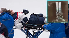 Sersen ukázal röntgenové snímky. Spolu so Šťastným sa budú liečiť mesiace