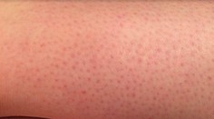 Dopadnete po holení takto? Môže za to nechutnosť, ktorú robí skoro každý