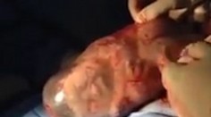 Dieťa sa narodilo v plodovom vaku. Takto vyzeral jeho prvý nádych na svete