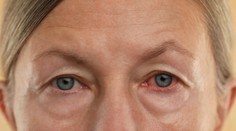 Oči môžu varovať pred chorobami. Upozornia na anémiu aj mozgovú príhodu