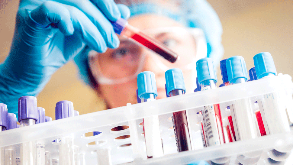 Vedci vyvinuli test, ktorý dokáže odhaliť rakovinu roky predtým, než sa ukážu príznaky