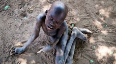 Rodičom pomaly odchádzajú pred očami. V srdci Afriky sa šíri záhadná choroba, ktorá deťom požiera mozgy