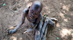 Rodičom pomaly odchádzajú pred očami. V srdci Afriky sa šíri záhadná choroba, ktorá deťom požiera mozgy