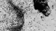 Úplne zblízka: Takto v našom tele ničia biele krvinky parazitov