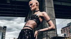 Modelky, ktoré sa presadili vďaka nezvyčajnej chorobe