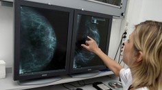 Strašiak mnohých žien. Lekárka vysvetlila, ako sa prejavuje rakovina prsníka