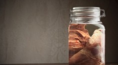 Desivá zbierka: Chorvát mal doma pohlavné údy mŕtvol. Odkiaľ ich vzal?