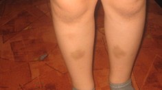 Pri slove škola dostanú strach. Stretla sa s ňou až tretina slovenských žiakov