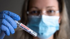 Vedci vyvinuli rýchlotest na opičie kiahne. Výsledok už za 15 minút