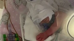 Obrovský smútok v Poľsku. Jedno z pätorčiat umrelo