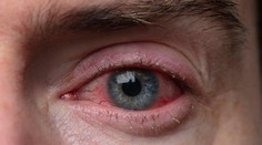 V Číne sa šíri vírus, ktorý napáda zrak. Vedci hovoria o nebezpečnom precedense