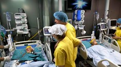 Už aj druhé z oddelených siamských dvojčiat v Bangladéši sa prebralo