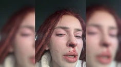 Do prípadu týranej influencerky sa zapojil aj generálny prokurátor M. Žilinka. Z toho, čo prežila, ide hrôza