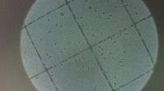 Počet párov, ktoré majú problém otehotnieť, sa stále zvyšuje