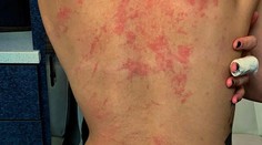 Nahá liezla po skalách a spadla. Speváčka zverejnila nelichotivé zábery