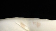 Obrovský trapas mladučkej sexice. S hnedými fľakmi na zadku!