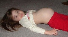 Príbeh päťročnej matky vás vydesil. Tu je lekárske vysvetlenie