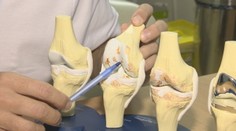 Na návšteve u ortopéda: Tejto chorobe sa nevyhne žiadny človek po 40