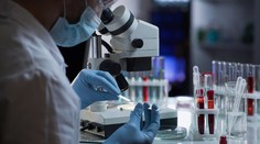 Nový výskum o šírení covidu. Za veľmi krátky čas stratí až 90 percent schopnosti infikovať ľudí