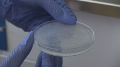 Hygienici stále testujú vzorky z kúpaliska v Štúrove. Boli sme sa pozrieť, ako skúmajú améby priamo v laboratóriách