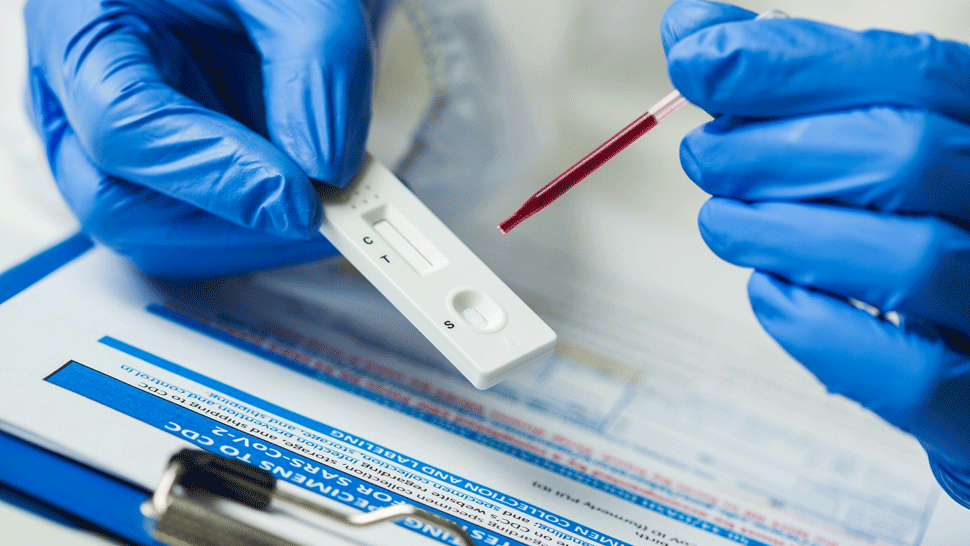 Vedci objavili ďalšiu látku, ktorá môže blokovať vstup koronavírusu do tela