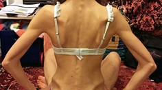 Povedali jej, že na balet nemá postavu. Takto to dopadlo