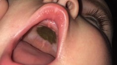 Matku vystrašila záhadná čierna škvrna v ústach dcéry. Keď zistila, o čo ide, musela sa smiať