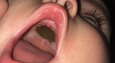 Matku vystrašila záhadná čierna škvrna v ústach dcéry. Keď zistila, o čo ide, musela sa smiať