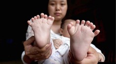 V Číne sa narodil chlapec, ktorý je iný ako ostatní