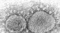 Biden podpísal zákon o odtajnení informácií o pôvode koronavírusu