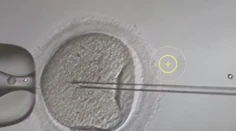 Dávajú nádej párom, ktoré majú problém počať dieťa. Ako vyzerá proces darovania vajíčok?